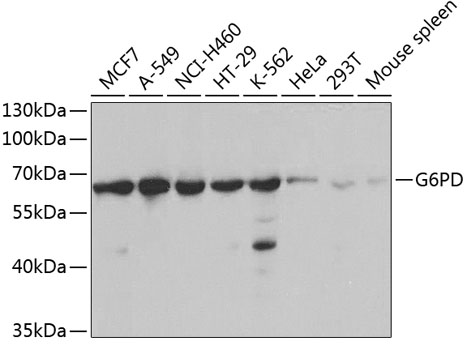 Anti-G6PD Antibody (CAB1537)