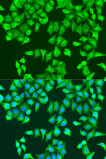 Anti-RHOA Antibody [KO Validated] (CAB15641)