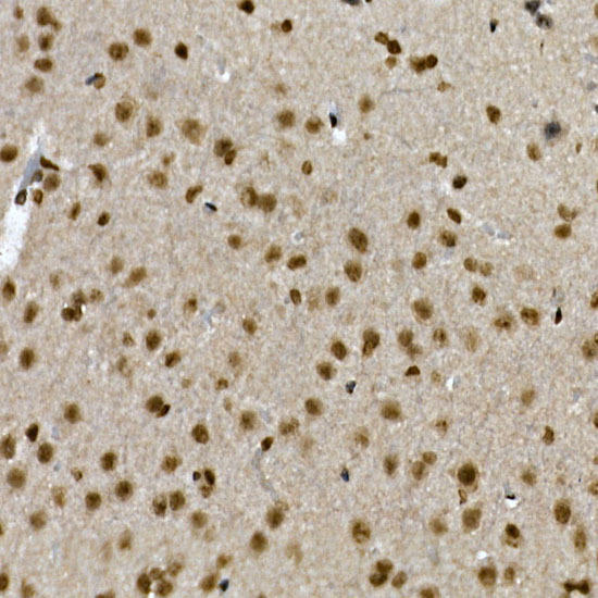 Immunohistochemistry of paraffin-embedded mouse brain using ZNF213 Rabbit pAb at dilution of 1:150 (40x lens). Perform high pressure antigen retrieval with 10 mM citrate buffer pH 6. 0 before commencing with IHC staining protocol.