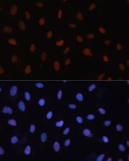 Anti-RB Antibody (CAB16966)