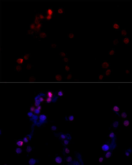 Anti-TBP Antibody (CAB16436)