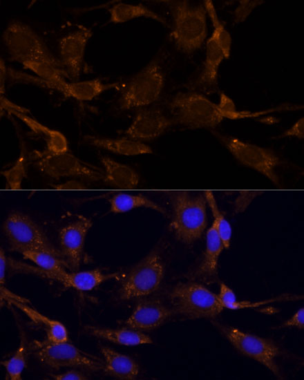 Anti-RPL27 Antibody (CAB13044)