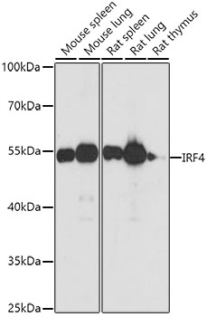 Anti-IRF4 Antibody (CAB0524)