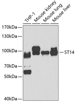 Anti-ST14 Antibody (CAB6135)