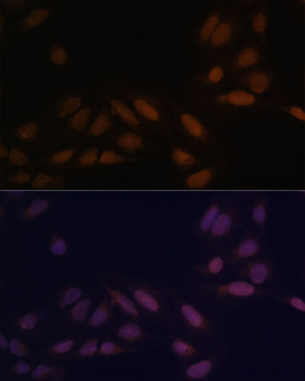 Anti-EED Antibody (CAB12773)