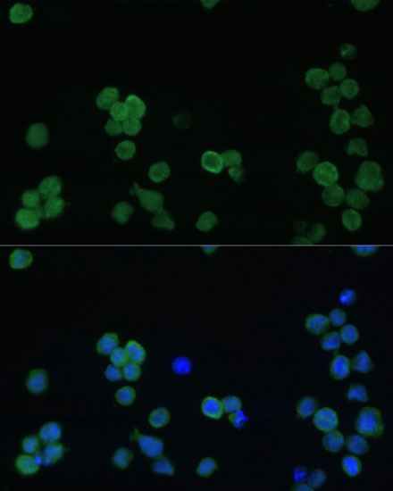 Anti-GP1BA Antibody (CAB16048)