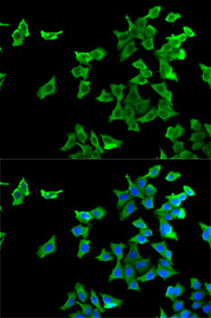 Anti-HTR2B Antibody (CAB5670)