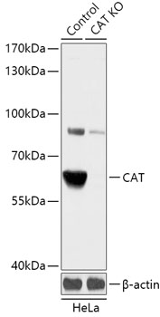 Anti-CAT Antibody [KO Validated] (CAB18018)