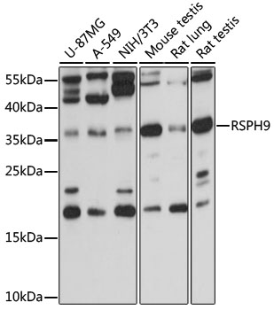 Anti-RSPH9 Antibody (CAB15972)