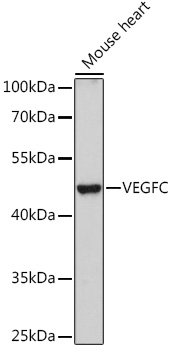 Anti-VEGFC Antibody (CAB12530)