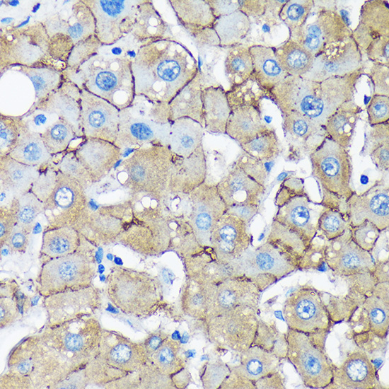 Anti-UNC13B Antibody (CAB15780)