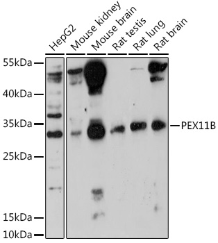 Anti-PEX11B Antibody (CAB18321)