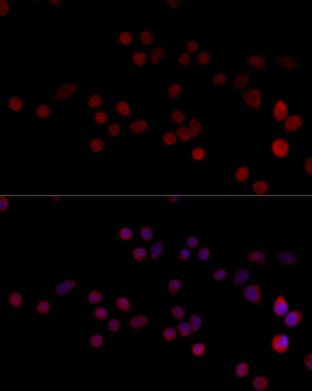 Anti-HNRPH3 Polyclonal Antibody (CAB8549)