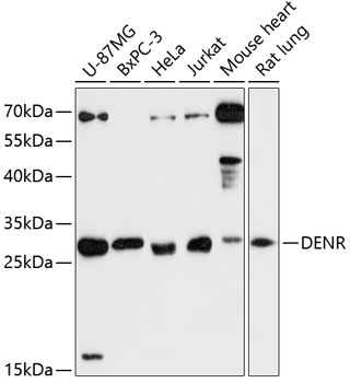 Anti-DENR Antibody (CAB13699)