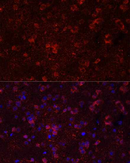 Anti-GRIN2B Antibody (CAB3056)