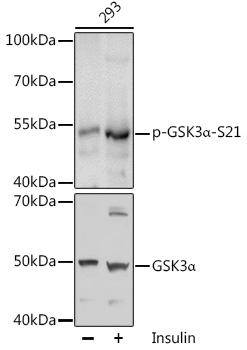 Anti-Phospho-GSK3A-S21 Antibody (CABP0582)