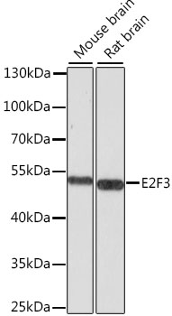 Anti-E2F3 Polyclonal Antibody (CAB8811)