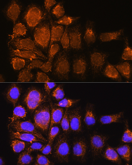 Anti-SYNE3 Antibody (CAB13237)