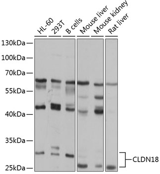 Anti-Claudin-18 Polyclonal Antibody (CAB8392)