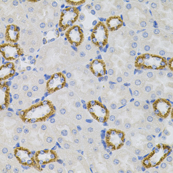 Anti-SIGMAR1 Antibody (CAB5479)