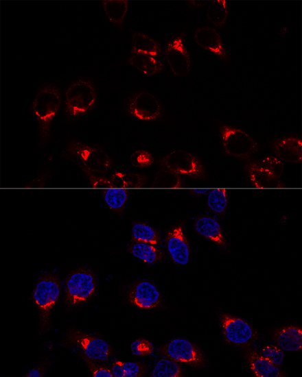 Anti-USO1 Antibody (CAB16079)