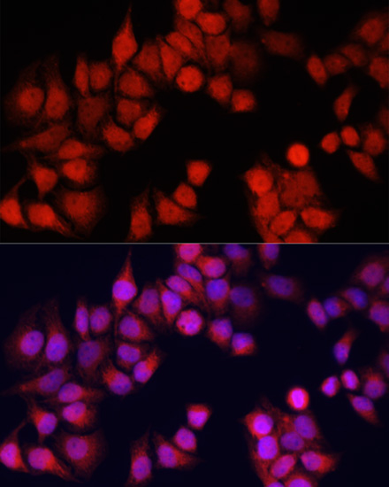 Anti-CSTB Antibody (CAB3815)