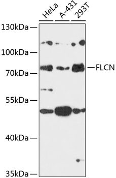 Anti-FLCN Antibody (CAB14521)