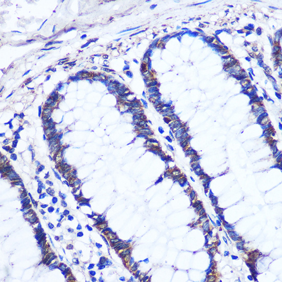 Anti-OTUD7B Antibody (CAB17329)