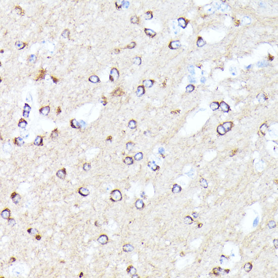 Anti-CCDC6 Antibody (CAB16075)