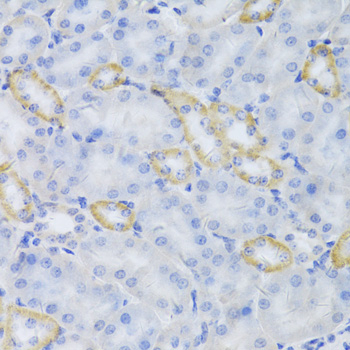 Anti-MRPS30 Antibody (CAB5841)