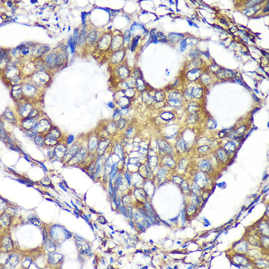 Anti-ACTR1B Antibody (CAB15773)