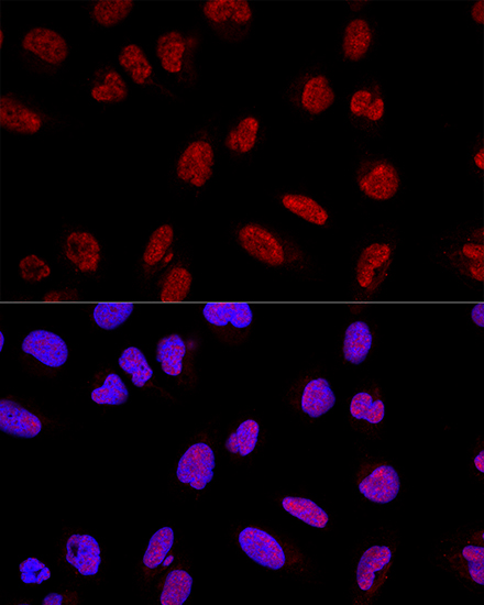 Anti-AKAP8 Antibody (CAB3049)