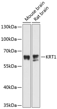 Anti-KRT1 Antibody (CAB11958)