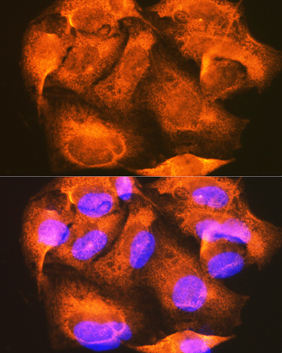 Anti-PHKG2 Antibody (CAB7337)