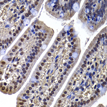 Anti-DNAJB6 Antibody (CAB7052)