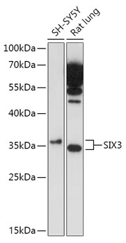 Anti-SIX3 Antibody (CAB17363)