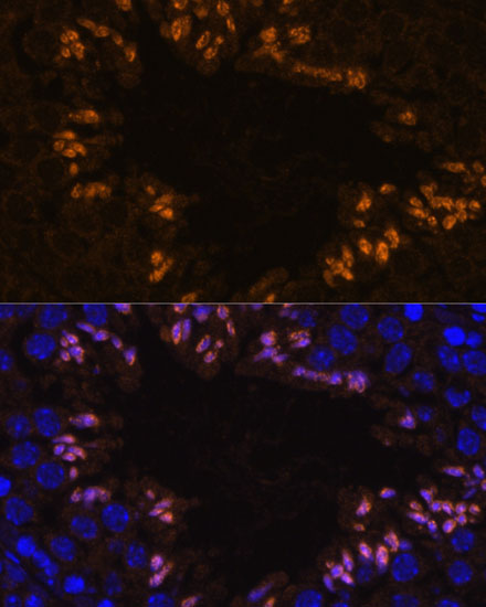 Anti-ELSPBP1 Antibody (CAB15882)