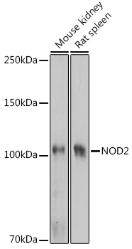 Anti-NOD2 Antibody (CAB15992)