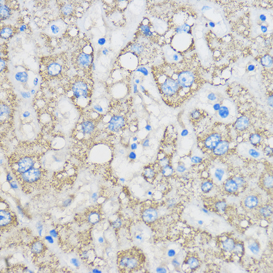 Anti-RARRES2 Antibody (CAB6963)