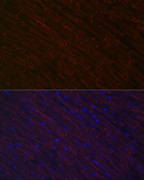 Anti-DES Antibody (CAB0699)