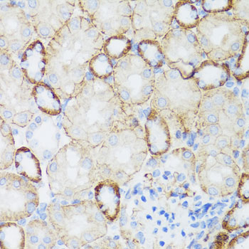 Anti-NEFH Polyclonal Antibody (CAB8442)