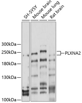 Anti-PLXNA2 Antibody (CAB10087)