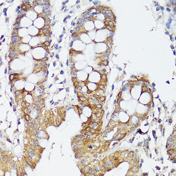 Anti-APP Antibody (CAB16265)