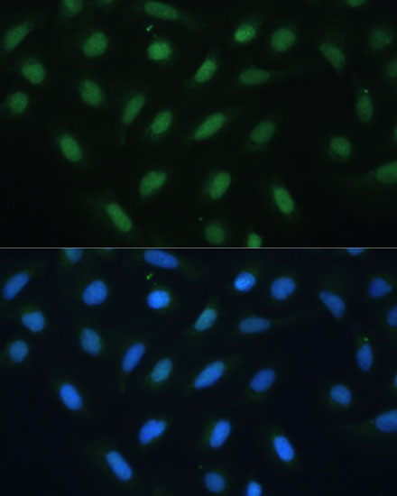 Anti-ATF3 Antibody (CAB13469)