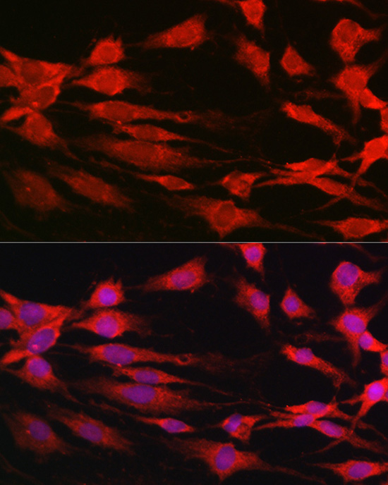 Anti-p70 S6 kinase Antibody (CAB2190)