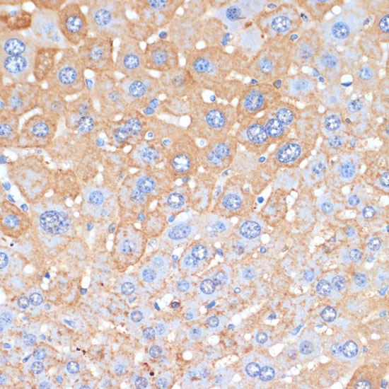 Anti-APCS Antibody (CAB1996)