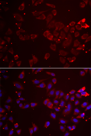 Anti-GATM Antibody (CAB6598)