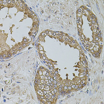 Anti-KTN1 Antibody (CAB5879)