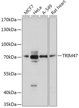 Anti-TRIM47 Antibody (CAB17803)