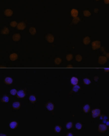 Anti-RB Antibody (CAB2116)